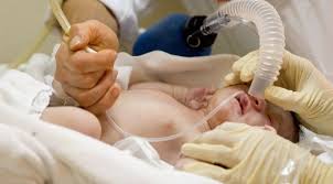 Penyakit Asfiksia Neonatorum - Gejala, Penyebab, Pengobatan - Klikdokter.com