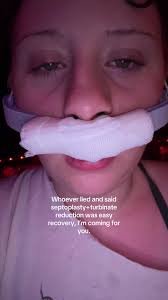 Turbine Nose Breathing