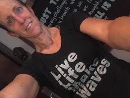 Completed my first 5k since Surgeries.