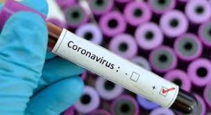 Con india reportando más de 300 mil nuevas infecciones por virus durante los últimos 19 días. Mientras En Uruguay E India Notifican Casos De Hongo Negro En Chile Confirman Pacientes Covid 19 Infectados Por Hongo Verde Diario Y Radio U Chile