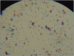 The aim of this study was to characterize the subtype and virulence potential of these l. Panorama De La Infeccion Por Listeria Monocytogenes