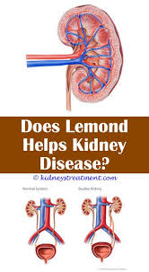 Chronic Kidney Disease Heartburn Kidney Disease Polycystic Kidney Disease Kidney Disease Symptoms