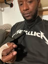 Longboarding fall injury experience