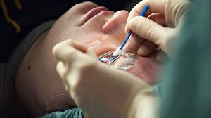 Patients need to have realistic expectations and come in with knowledge of what's going to be involved. Pros And Cons Of Lasik Are The Risks Worth The Cost