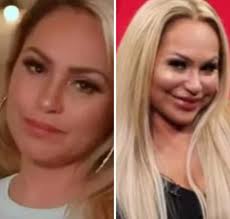 Darcey Silva's Extreme Makeover: Fillers Gone and Jaw-Dropping Result