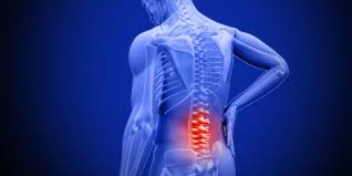 Kepakaran sya membantu mengurangkan sakit tulang belakang dan memastikan anda dihindari dengan. 12 Cara Hilangkan Sakit Pinggang Dengan Mudah The Diagnosa