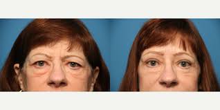 Brian M. Derby, MD, FACS, Board Certified Plastic Surgeon