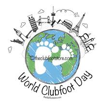 Clubfoot is a birth defect that makes one or both of a baby's feet point down and turn in. World Clubfoot Day Logos