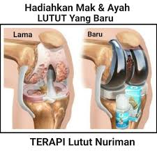 Sakit lutut merupakan salah satu masalah yang mengganggu kebanyakan individu. Ubat Sakit Lutut Sendi Gel Lutut Nur Iman Shopee Malaysia