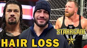 The trio declared themselves the shield and vowed to rally against injustice. Roman Reigns Hair Loss Due To Leukaemia Wwe Starrcade 2018 Highlights Results Youtube