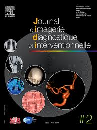 Survient dans 18% des traumatismes de la rate. Comment Je Fais Un Scanner Simple Energie Pour Embolie Pulmonaire Aigue Epa