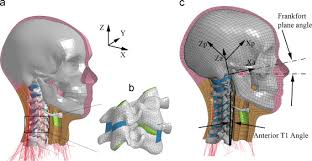 Head, neck, and back anatomy. A Female Head Neck Model For Rear Impact Simulations Sciencedirect