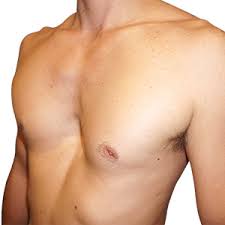 Image result for Pectus Excavatum
