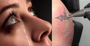Does it hurt, how much it costs & other faqs. How Much Does Laser Tattoo Removal Hurt Tattoo Ideas Artists And Models