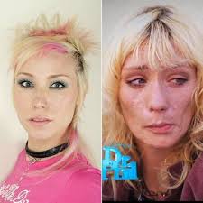 Using meth can significantly alter a person's appearance and physical health, but this doesn't mean that a better life isn't possible. 7 Celebrity Faces Of Addiction Everyday Health