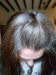 Please Hair Grow Faster It S Been 100 Days And Still So Much More To Do Transition To Gray Hair Gray Hair Growing Out Grey Silver Hair