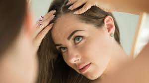 Gaya rambut botak bagian garis rambut kesalahan menyisir rambut bisa menyebabkan garis rambut semakin surut dan menipis. Kebotakan Pada Wanita Gejala Penyebab Dan Perawatan Orami