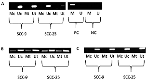 Download termux for pc (windows and mac). Zebularine Induces Prolonged Apoptosis Effects Via The Caspase 3 Parp Pathway In Head And Neck Cancer Cells