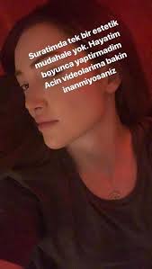 Nov 05, 2020 · hafsanur sancaktutan'ın burnu estetiktir. Danla Bilic Estetik Yaptirmadigini Soyleyince Alay Konusu Oldu