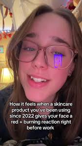 Itk Tri Acid Toner Review Burning