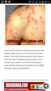 Demam campak atau rubeola berlaku akibat jangkitan virus measles. Imran Demam Campak Anoi Nawawi