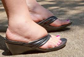 фото отечных ног 2