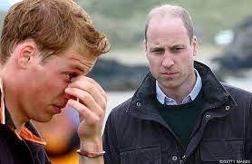 Der 35 jahre alte prinz william präsentierte seinen neuen schnitt bei dem besuch eines kinderkrankenhauses in london. Prinz William Glatzen Skandal