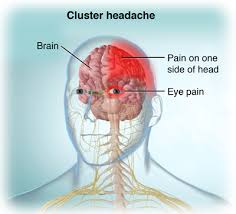Headaches that involve pain in the back of the head can have a number of different causes. Headache Cedars Sinai