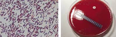 Check spelling or type a new query. Infektionen Mit Clostridium Difficile Neue Europaische Leitlinie Trillium Gmbh Medizinischer Fachverlag