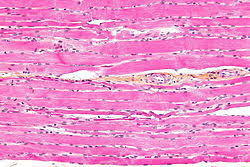 The cells are so small that we can only see them under a microscope. Striated Muscle Tissue Wikipedia