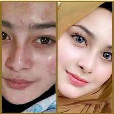 Cara memutihkan gigi dengan kulit limau atau kulit oren putihkan gigi guna strawberi bonus jika menggunakan cara ini, ia senang dibawa ke mana saja. Car Cara Memutihkan Wajah Dengan Cepat Alami Dan Permanen