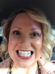 Braces with great customer service and payment plans