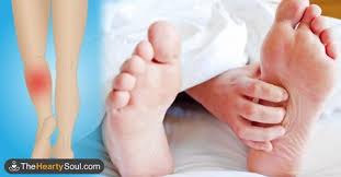 Why Your Legs Cramp At Night And How To Keep It From Happening Again Treatment For Restless Legs Restless Legs Restless Leg Syndrome