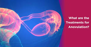 Image result for Anovulation