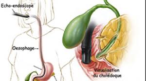 du endoscopie digestive center