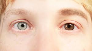 People Change Their Eye Color For A Week Youtube