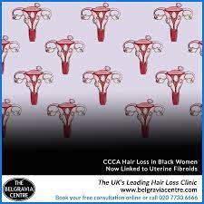 John lipman of atlanta fibroid center explains why hysterectomy or partial hysterectomy is absolutely unnecessary when it comes to fibroid treatment. Belgravia Centre On Twitter Ccca Hair Loss In Black Women Linked To Uterine Fibroids Https T Co R0q65jhj3d Hairloss Afrohair Blackhair Woc Fibroids Womenshealth Hairlosshelp Womenshair Womenshairloss Ccca