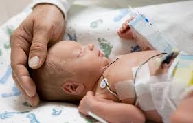 Image result for Preterm Infant