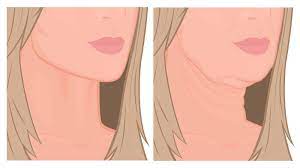 New hair look love hair edgy short hair short hair styles curl hair overnight natural hair care natural hair styles curled hairstyles cool hairstyles. Dermatologists Explain How To Prevent Sagging Jowls