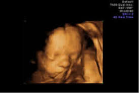 Engineering und ultraschall imaging techniken, liefert hervorragende bildqualität, hervorragende klinische leistung. Schwangerschaft 3d 4d Ultraschall