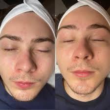 𝙲𝙰𝙼𝚁𝚈𝙽 𝙴𝙻𝙸𝚂𝙴 𝙴𝚂𝚃𝙷𝙴𝚃𝙸𝙲𝚂 (@camrynelise_esthetics) •  Instagram photos and videos