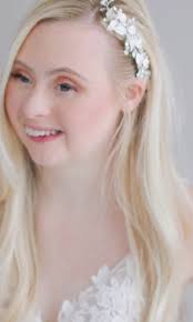 Bullied Woman With Down Syndrome Persevered And Is Now The Face Of Fashion  Campaigns 😍 video in the comments 👇