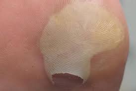Cand apare spuma, varsam apa, spalam carnea si acoperim iarasi cu apa rece, si o o gaina de casa; Basicile Bataturile De Picioare Prevenire Si Vindecare Enciclopedie DeschisÄ