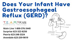 Image result for Pediatric Reflux