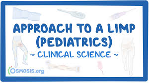 Image result for Pediatric Limp