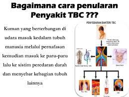 Tb bisa berakibat fatal, tetapi dalam banyak kasus, tb dapat dicegah dan diobati. Tuberculosis Tbc Oleh Dr Adip Kusworo Ppt Download