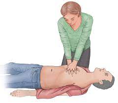 Im falle fehlender atmung oder schnappatmung ist eine herzdruckmassage also zwingend notwendig. Was Ist Bei Der Wiederbelebung Wichtig