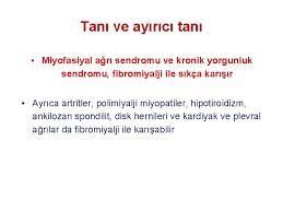 Sonuçta, miyofasiyal ağrı sendromu olan kaslardaki gerginlik ve ağrı, kaslardaki yapısal lomber bölgenin miyofasyal sendromu, kasık veya siyatik sinirlere yayılabilen sırtın aynı zamanda, ağrı sendromu ve tanı sırasında bulunan ve kas ağrısını provoke. Tendntler Tendnt Tendnoss Tenovagnts Genel Olarak Her Terim