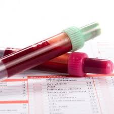 Vin aici in speranta unuei sfat! Inr Valori Normale Divahair Ro