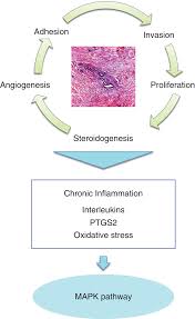Die wirkstoffe der yasmin pille sind in erster linie die weiblichen geschlechtshormone drospirenon und. Diagram Of Ectopic Implantation In Endometriosis Retrograde Download Scientific Diagram